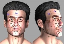 chirurgie_maxilo_faciala