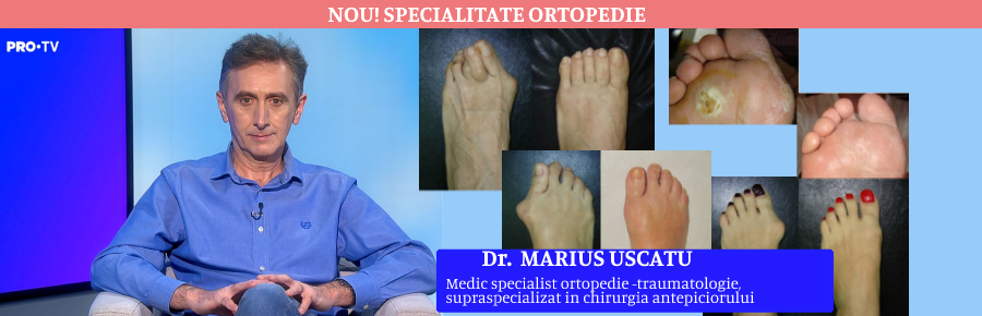 ortopedie